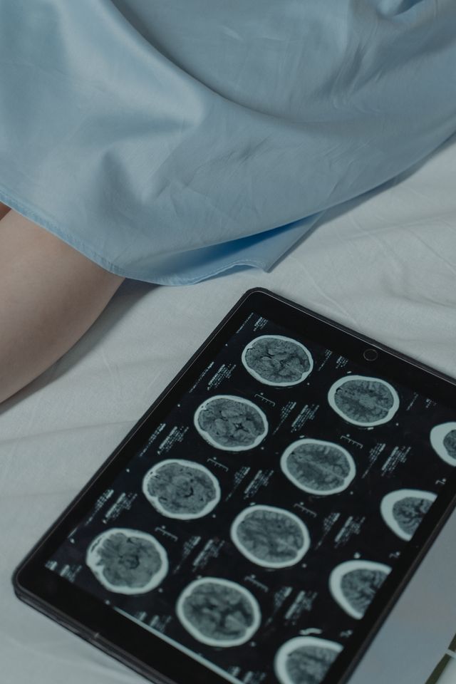 Human brain and computer technology representing the differences between human memory and AI memory.